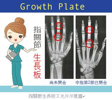 「生長板」是影響身高的主因